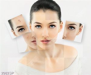 Tranh nghệ thuật những nốt mụn ẩn dưới làn da cô gái