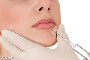 Tranh cô gái tiêm filler làm đẹp vào môi