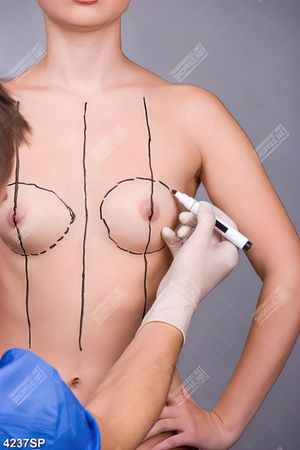 Tranh phẩu thuật thẩm mỹ