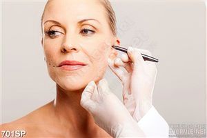 Tranh spa chăm sóc nếp nhăn