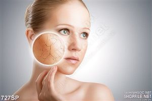 Tranh spa cô gái và làn da khô