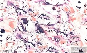 Vân đá, Marble nền trắng vân tím đỏ