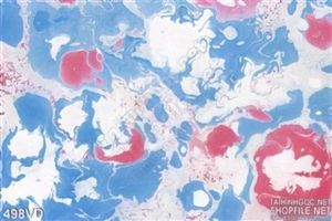 Vân đá, Marble vân trắng pha đỏ