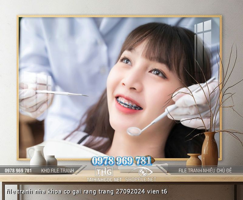 file tranh nha khoa co gai rang trang 27092024 vien t6