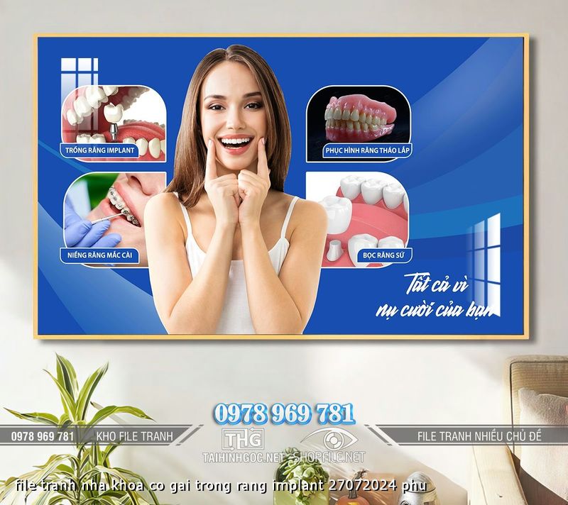 file tranh nha khoa co gai trong rang implant 27072024 phu