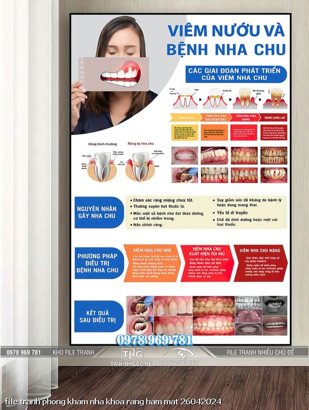 file tranh phong kham nha khoa rang ham mat 26042024