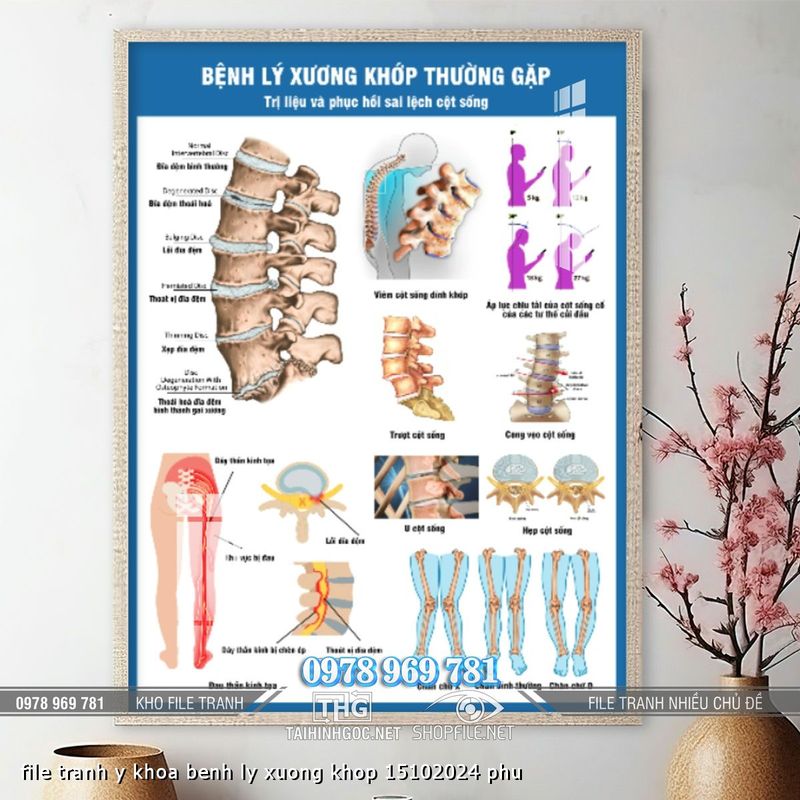 file tranh y khoa benh ly xuong khop 15102024 phu