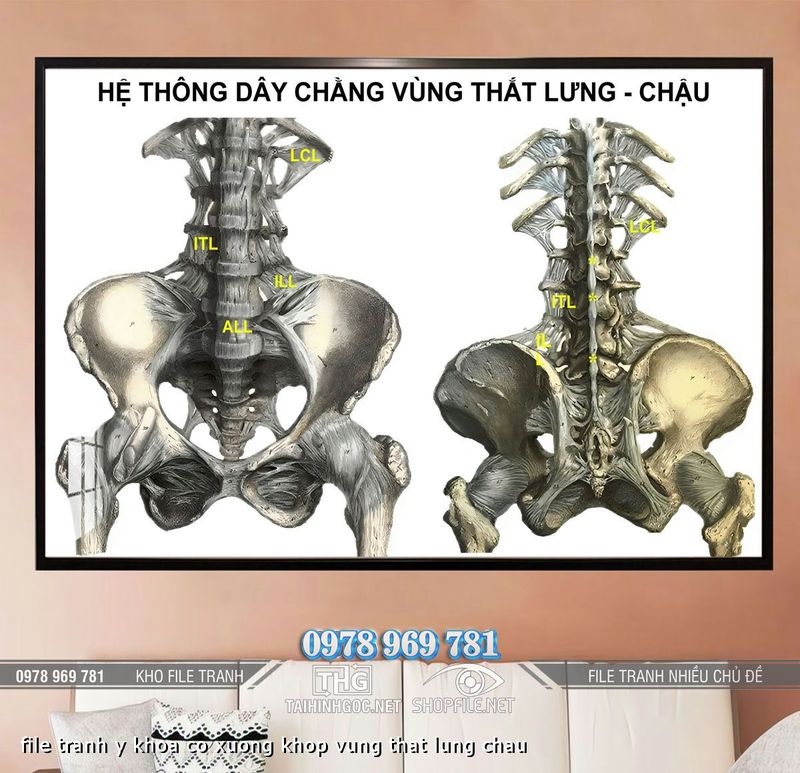 file tranh y khoa co xuong khop vung that lung chau