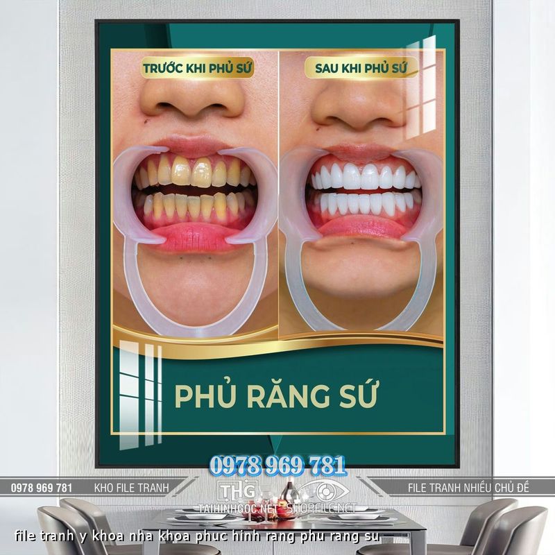 file tranh y khoa nha khoa phuc hinh rang phu rang su