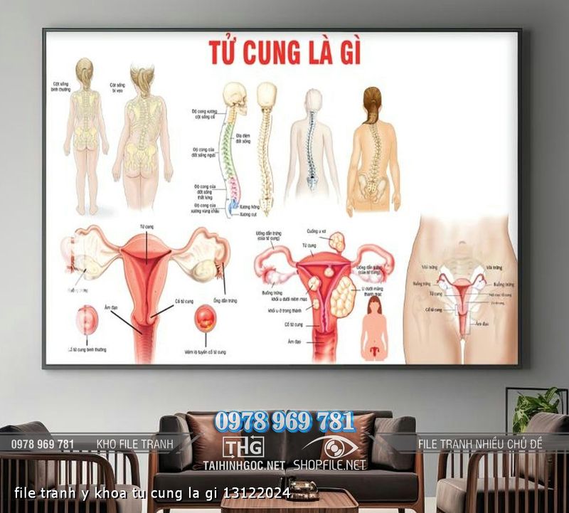file tranh y khoa tu cung la gi 13122024